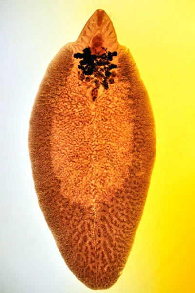 liver-fluke