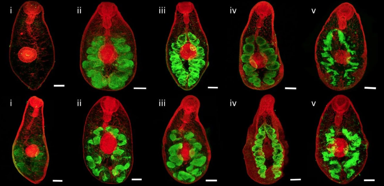 Infection by the helminth parasite Fasciola hepatica requires rapid regulation of metabolic, virulence, and invasive factors to adjust to its mammalian host