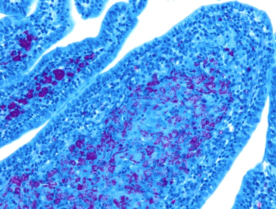 Fig. 1: Ziehl – Neelsen stain of ileal section of a Johne’s disease clinical animal. Ileal villi with inflammatory infiltrate is shown with large numbers of acid fast bacteria found within the infiltrated macrophages (image shown at 200x).