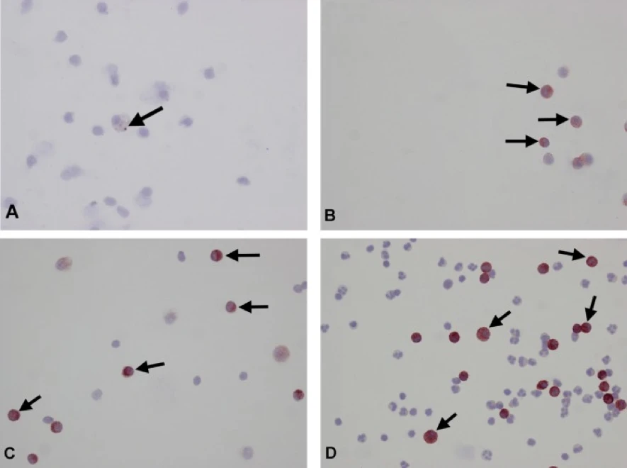 Fig. 1. Peritoneal smear stained with anti-CD206 polyclonal antibody showing mild cytoplasmic immunolabelling (brown colour) in macrophages (arrows) from uninfected control (A) and very severe immunolabelling in macrophages at 1 day post-infection (dpi) (B), 9 dpi (C), and 18 dpi (D). ABC method-haematoxylin counterstain. ×400.